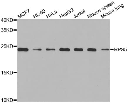 Polyclonal Rabbit anti-Human RPS5 / Ribosomal Protein S5 Antibody (IHC, IF, WB)
