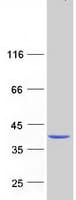 Human ABHD6 Protein (Recombinant Myc-DDK (Flag))