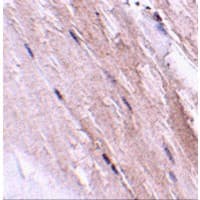 GBAS Antibody