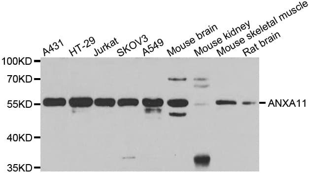 ANXA11 / Annexin XI Antibody