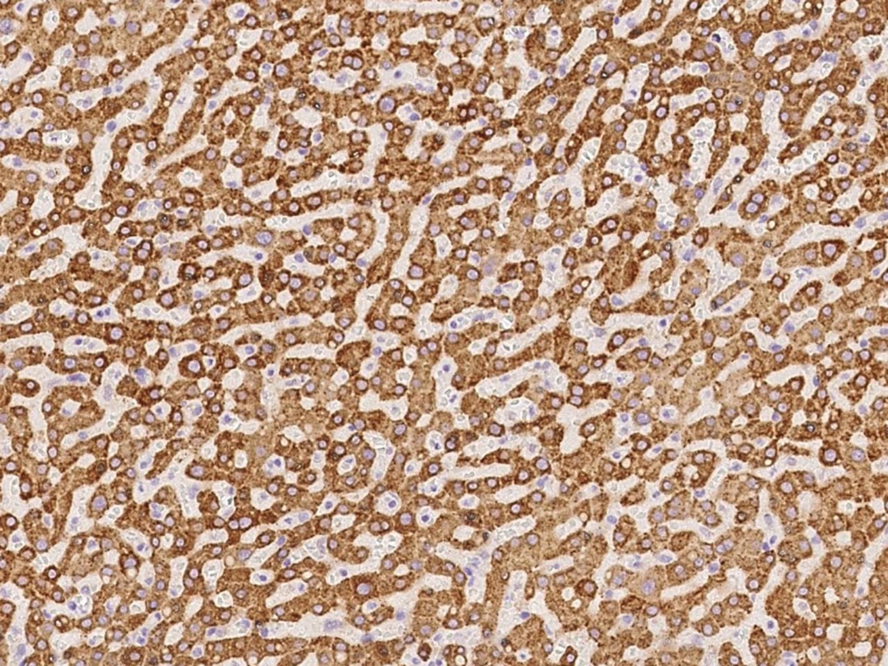 METTL7B Antibody