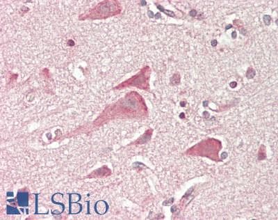 IHC-plus™ FGF10 Antibody (aa136-165)