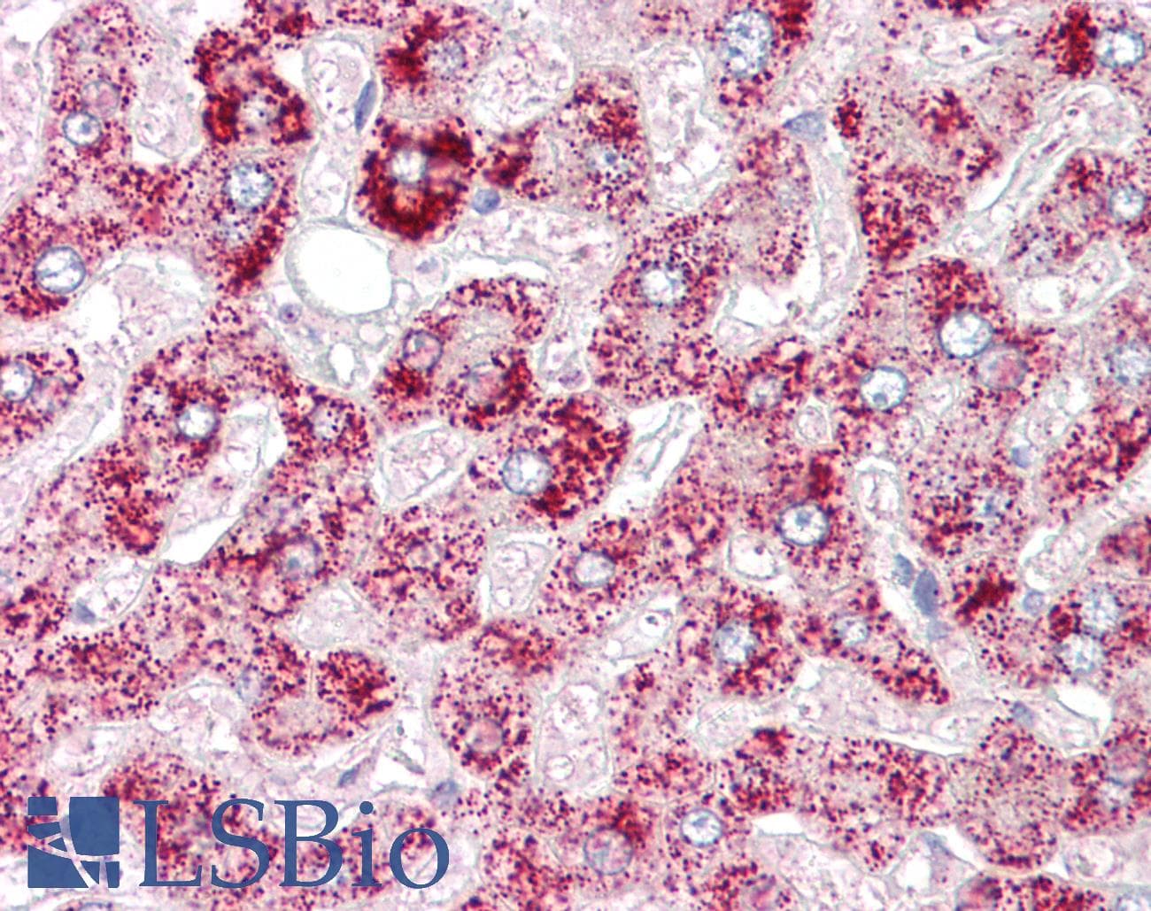 IHC-plus™ Polyclonal Rabbit anti-Human ORMDL1 Antibody (IHC, IF, WB)