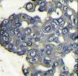 PIK3CD / PI3K Delta Antibody (aa85-114)