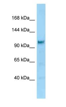 Polyclonal Rabbit anti-Rat DIAPH2 Antibody (C-Terminus, WB)