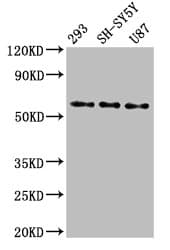 SLC11A2 / DMT1 Antibody