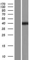 ELMOD1 Protein (Over-Expression Lysate Myc-DDK (Flag))
