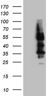 Monoclonal Mouse anti-Human SSTR4 Antibody (clone OTI2F11, C-Terminus, WB)