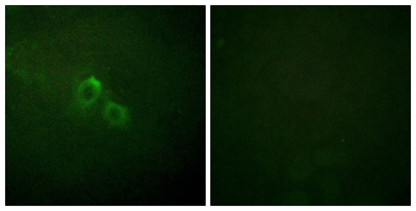 Polyclonal Rabbit anti-Human KCNA3 / Kv1.3 Antibody (Ab-135, IHC, IF)