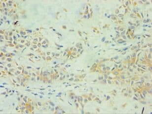 SPINT1 / HAI-1 Antibody (aa250-529)