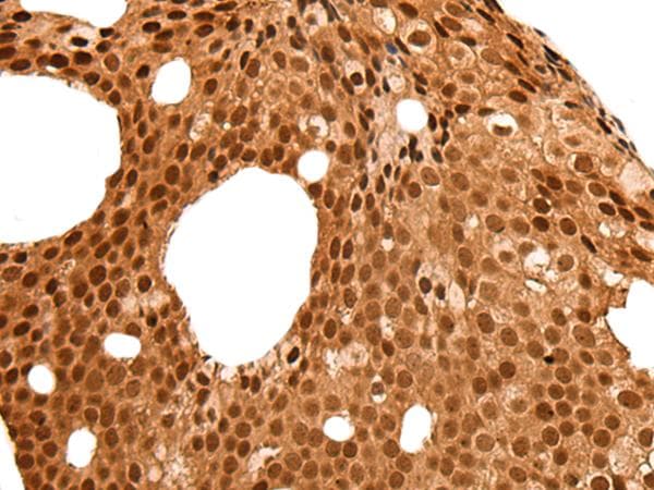 Polyclonal Rabbit anti-Human NEK7 Antibody (IHC)