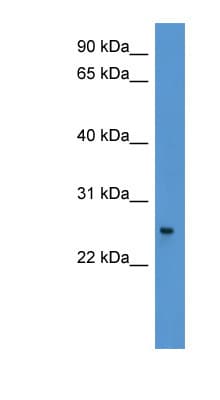 PYCARD / ASC / TMS1 Antibody (aa121-170)