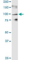 Monoclonal Mouse anti-Human VR1 / TRPV1 Antibody (clone 1A8, WB)