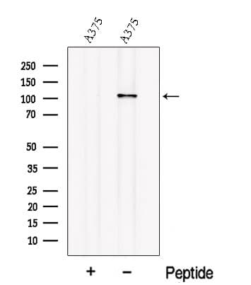 OSMR / IL-31R-Beta Antibody