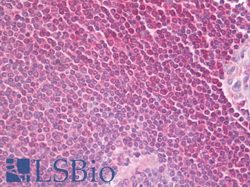 IHC-plus™ PLCG2 / PLC Gamma 2 Antibody (aa721-770)