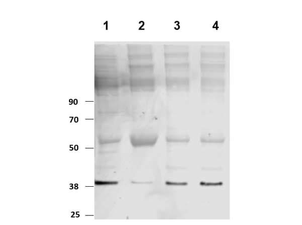PKM / Pyruvate Kinase, Muscle Antibody (Internal)