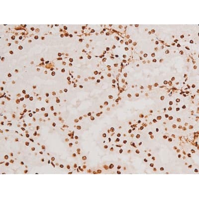 Polyclonal Rabbit anti-Human SYK Antibody (phospho-Tyr348, IHC, IF, WB)