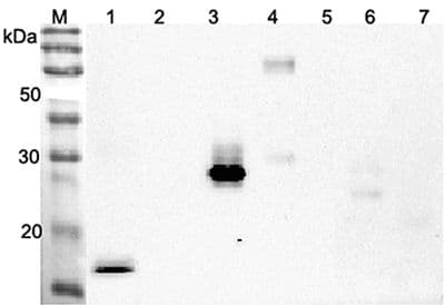 ANGPTL4 Antibody (Coiled-coil domain)