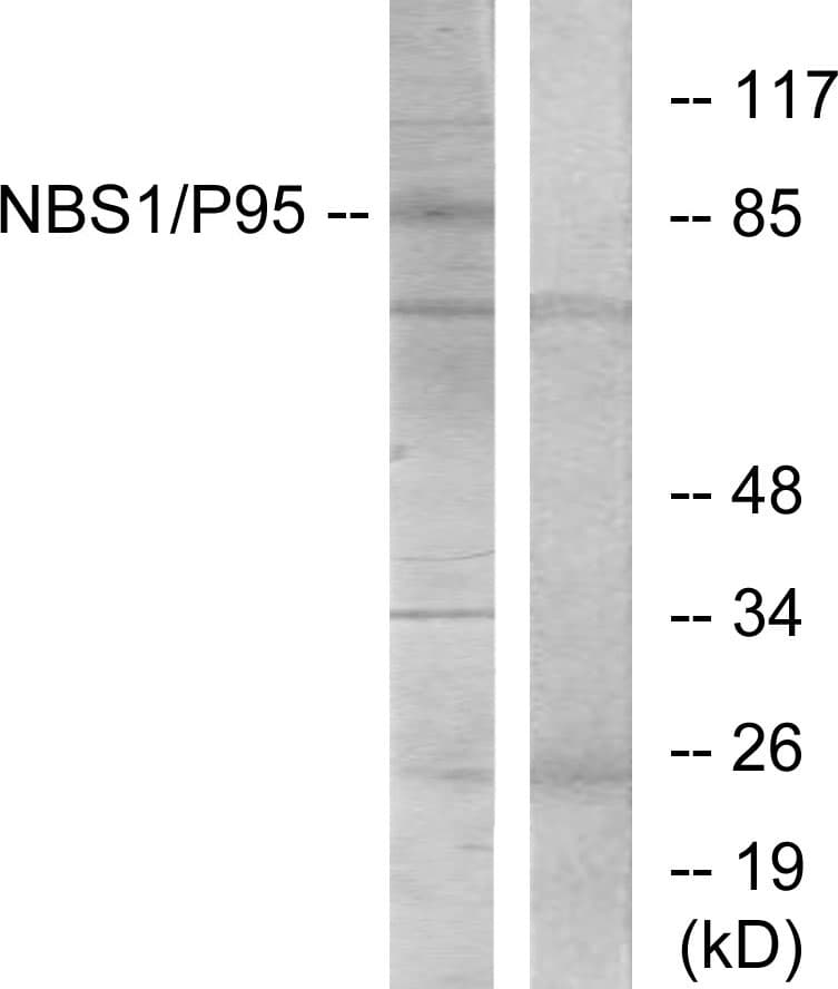 NBN / Nibrin Antibody (aa310-359)