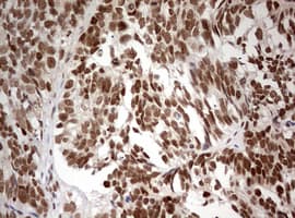 Monoclonal Mouse anti-Human TRIM24 / TIF1 Antibody (clone OTI2D9, aa706-1016, IHC, WB)