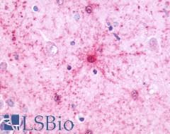 PathPlus™ NMBR Antibody (C-Terminus)