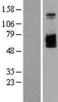 Human IL2RB / CD122 Protein (Over-Expression Lysate Myc-DDK (Flag))
