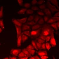 COPS6 / CSN6 Antibody