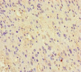 Polyclonal Rabbit anti-Human MCRS1 / MSP58 Antibody (IHC, WB)