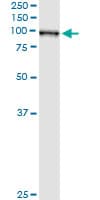 GLNRS / QARS Antibody (clone 5F5)