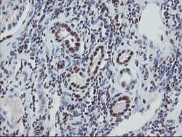 Monoclonal Mouse anti-Human TPRKB Antibody (clone OTI1E9, IHC, WB)