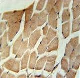 Polyclonal Rabbit anti-Human MARCH5 Antibody (aa4-32, IHC, WB)