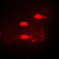 CALCOCO1 / CoCoa Antibody