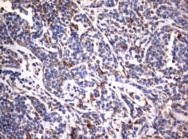 Monoclonal Mouse anti-Human Vimentin Antibody (clone OTI5D7, IHC, WB)