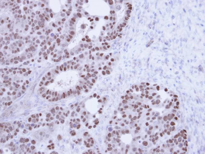NXF1 / TAP Antibody (aa1-151)
