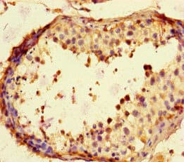 NAK / TBK1 Antibody