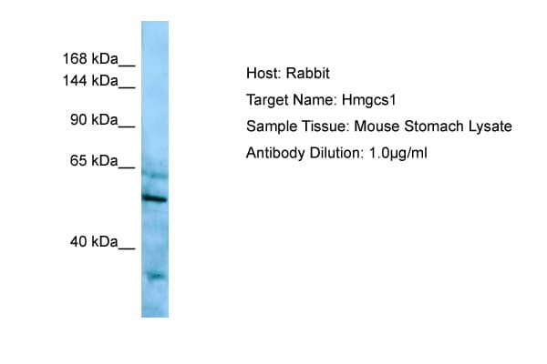 Polyclonal Rabbit anti-Mouse HMGCS1 / HMG-CoA Synthase 1 Antibody (C-Terminus, IHC, WB)