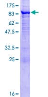 Human NDOR1 Protein (Recombinant GST)