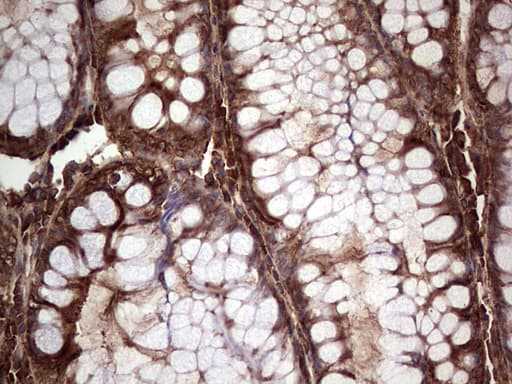 PKM2 Antibody (clone 1G10)