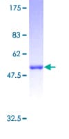 Human RAB27B Protein (Recombinant GST)