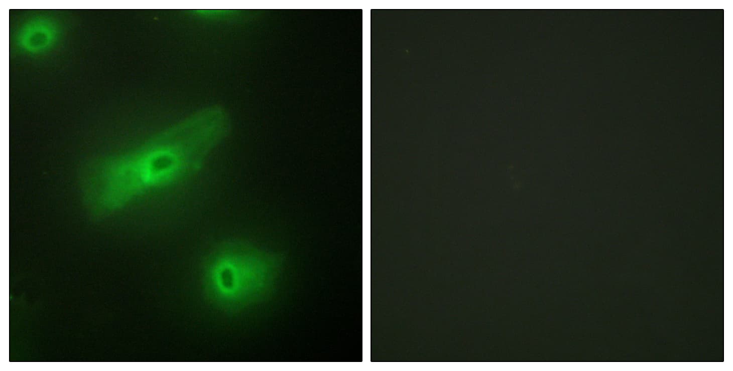 IHC-plus™ Polyclonal Rabbit anti-Human TNFSF13 / APRIL Antibody (aa151-200, IHC, IF, WB)