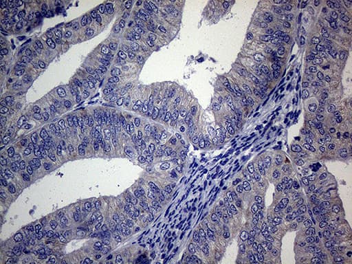 ACVR2 / ACVR2A Antibody (aa214-513, clone OTI1F2)