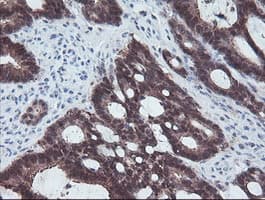 ACY1 / Aminoacylase 1 Antibody (clone OTI2F1)