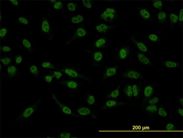 SMAD5 Antibody (clone 2D7)