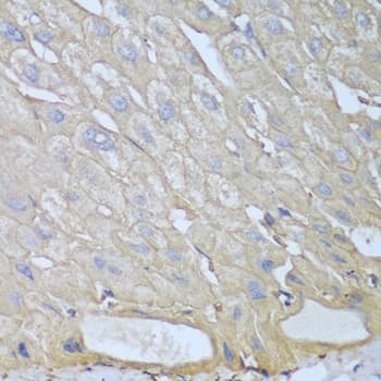 RPH3AL Antibody
