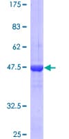 Human RAB1A Protein (Recombinant GST)