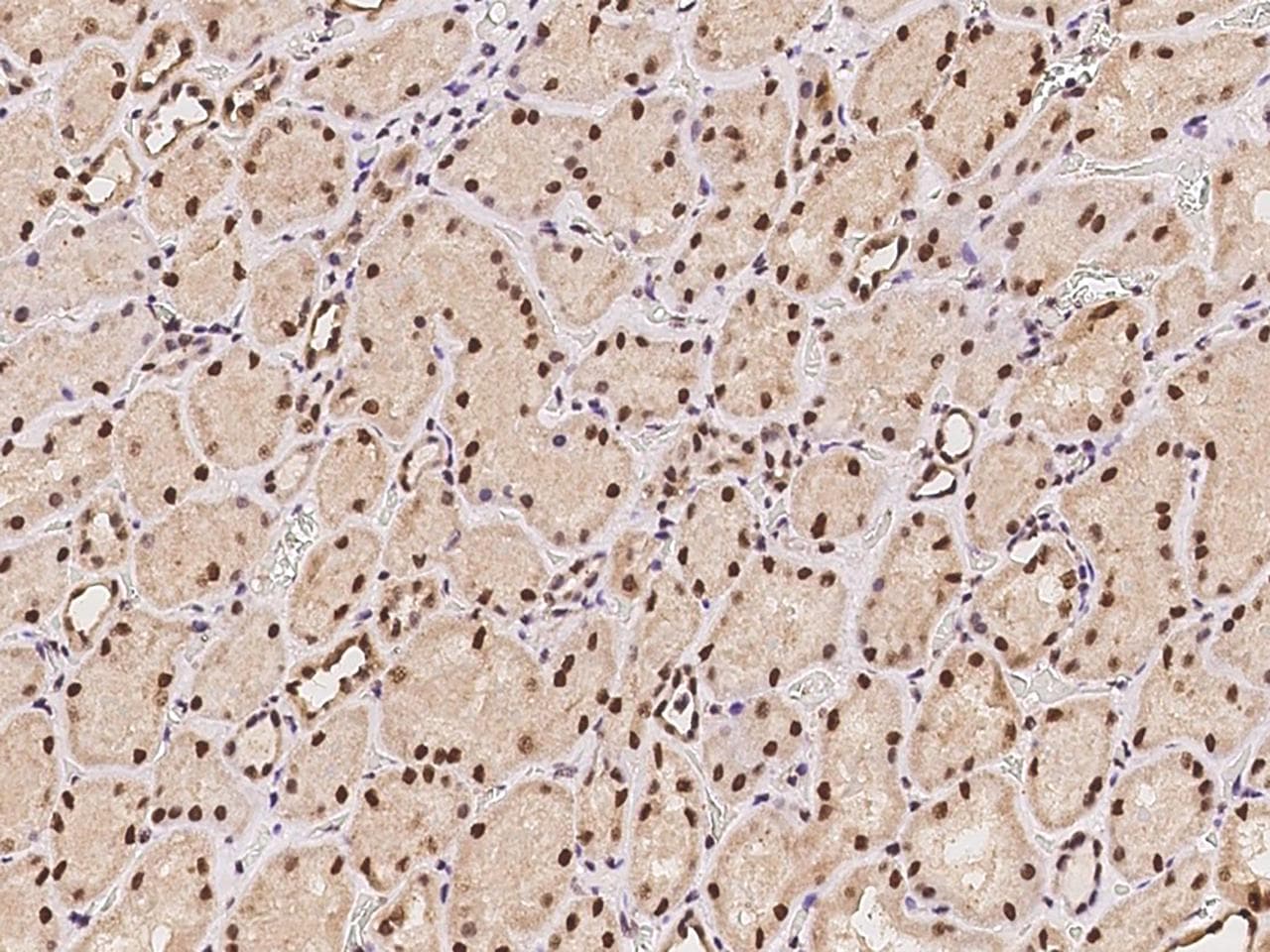 CTDSP2 Antibody