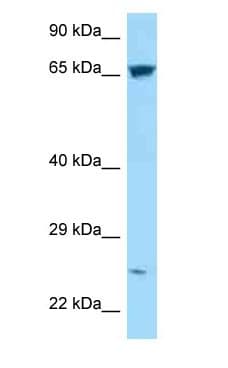 Polyclonal Rabbit anti-Human HEATR9 Antibody (aa473-522, WB)