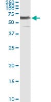 IHC-plus™ PHGDH Antibody (clone 4A3-1D6)