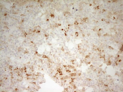 CPB2 / TAFI Antibody (aa224-423, clone OTI3D5)