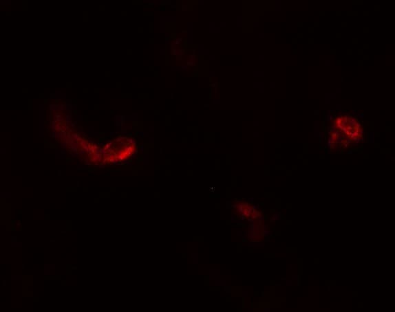 IHC-plus™ Polyclonal Rabbit anti-Human LEMD3 / MAN1 Antibody (IHC, IF, WB)